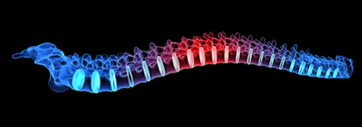 Chiropractic Campbell CA Back Pain Spine Chiropractic Campbell CA Back Pain Spine