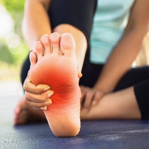 A woman holding the bottom of her foot in pain